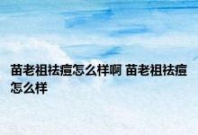 苗老祖祛痘怎么样啊 苗老祖祛痘怎么样 